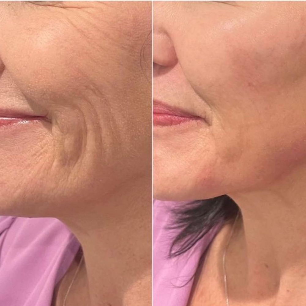 Linda R., 57